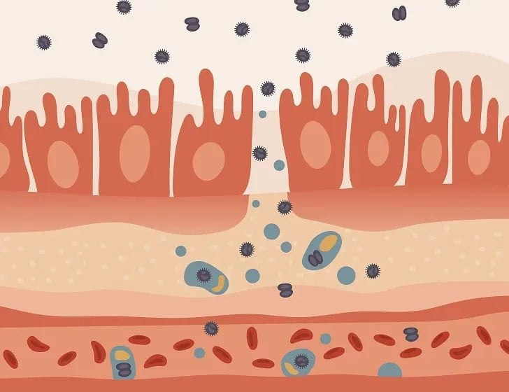 Ilustración de las vellosidades intestinales inflamadas