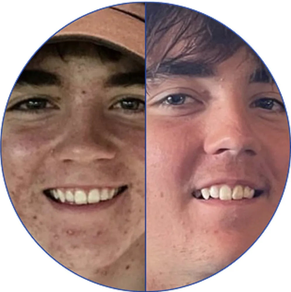 Antes y después, caso 4