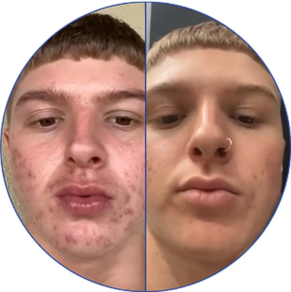 Antes y después, caso 7