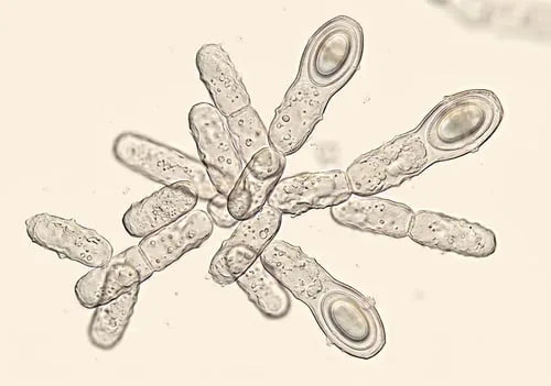 Bacillus coagulans