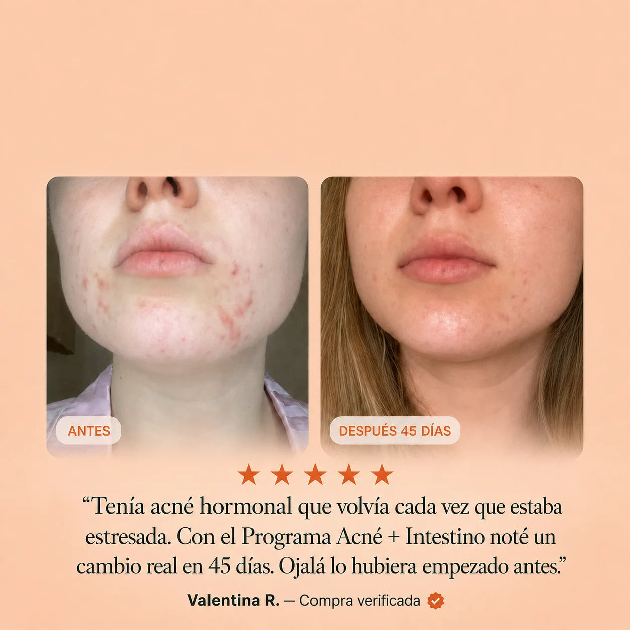 Antes y después de Valentina R., con su reseña